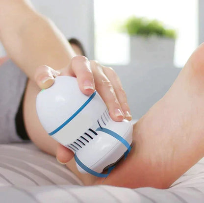 AEROLOOP Vacuum Callus Remover